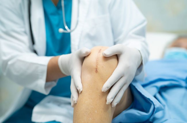 Total Joint Replacement
